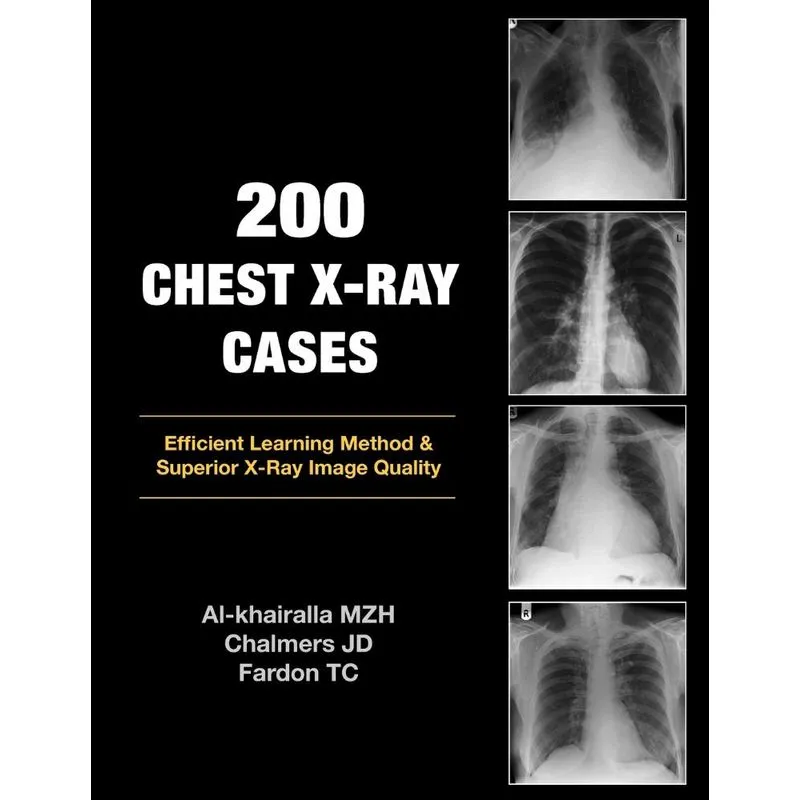 200 Chest X-Ray Cases