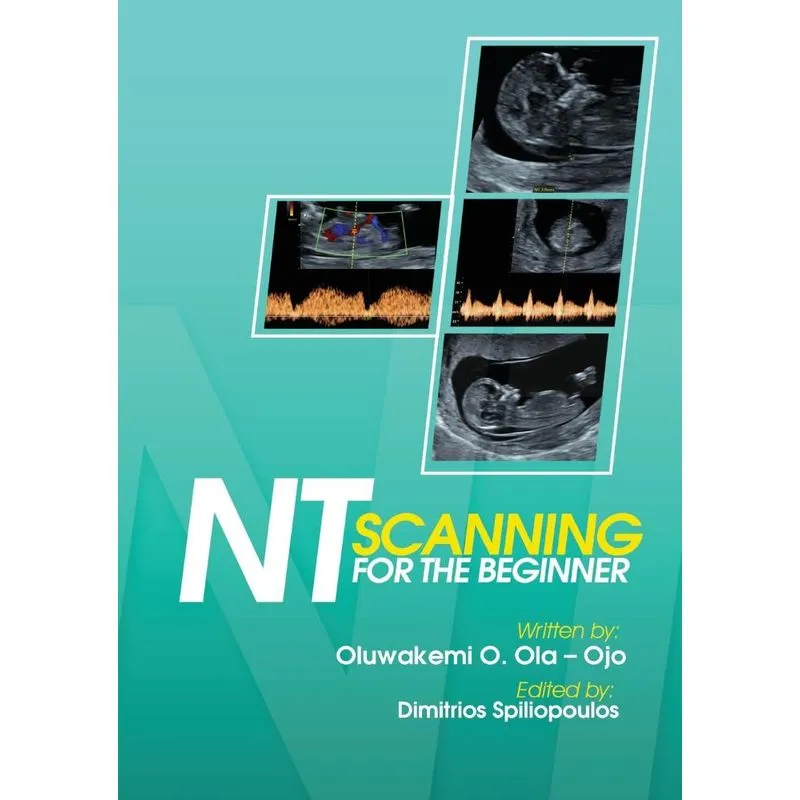 NT Scanning for the Beginner