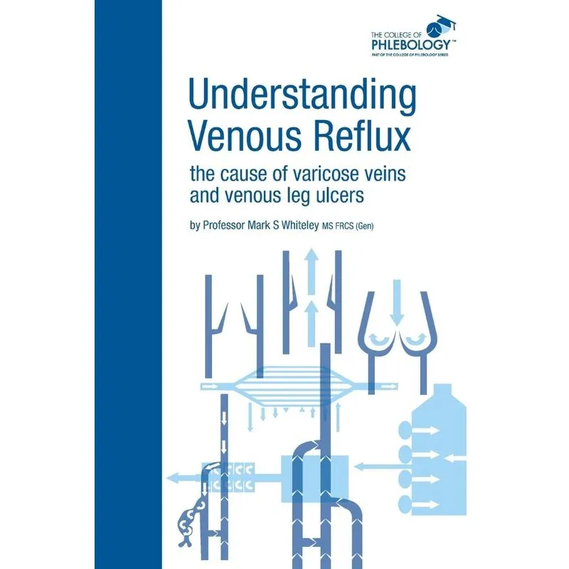 Understanding Venous Reflux the Cause of Varicose Veins and