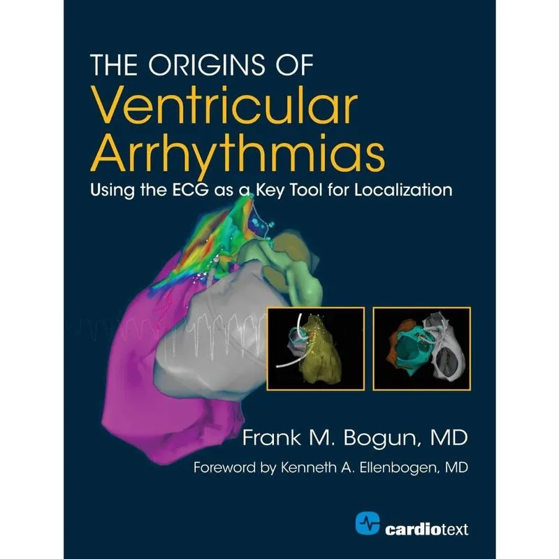 The Origins of Ventricular Arrhythmias