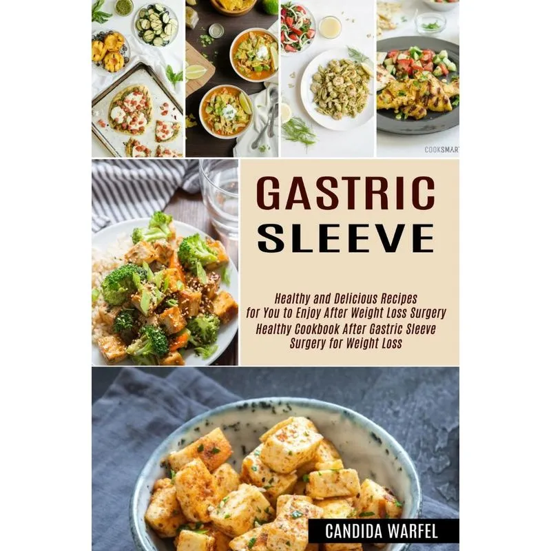 Gastric Sleeve