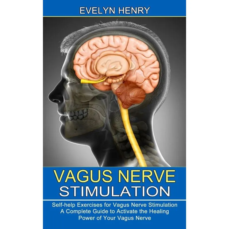 Vagus Nerve Stimulation