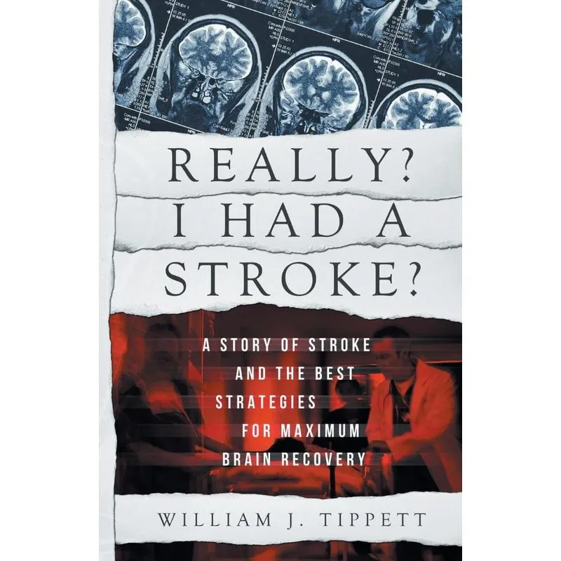 Really? I Had A Stroke?