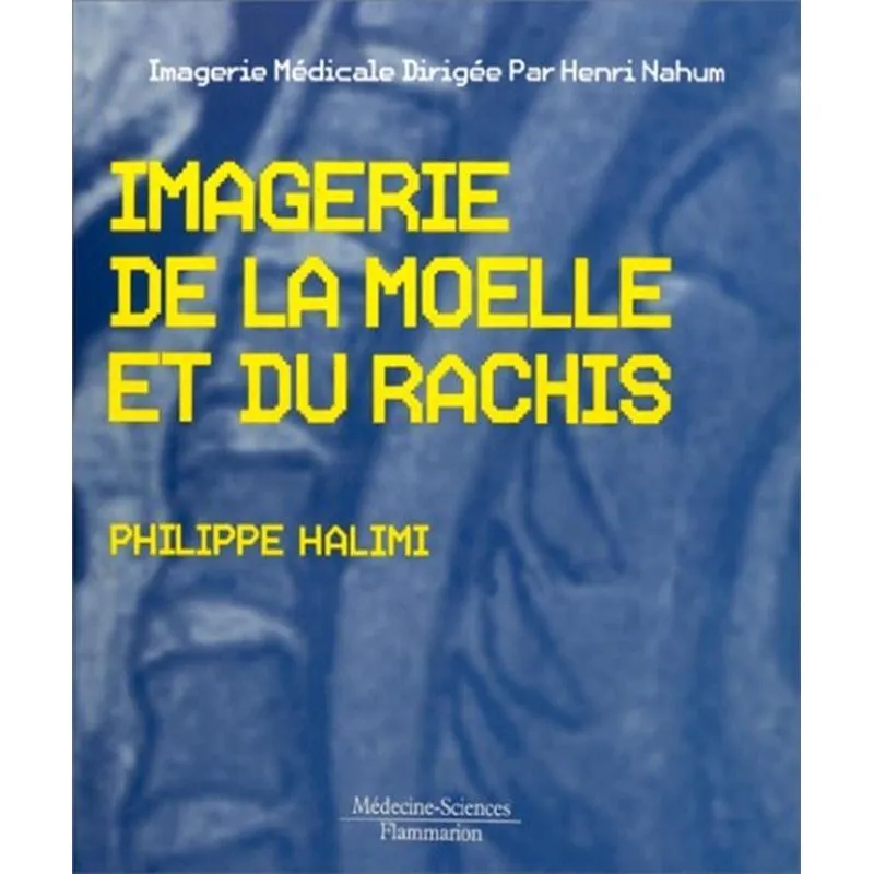 Imagerie De La Moelle Et Du Rachis
