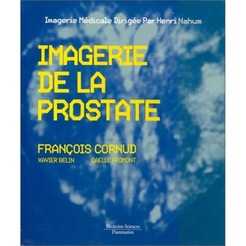Imagerie De La Prostate