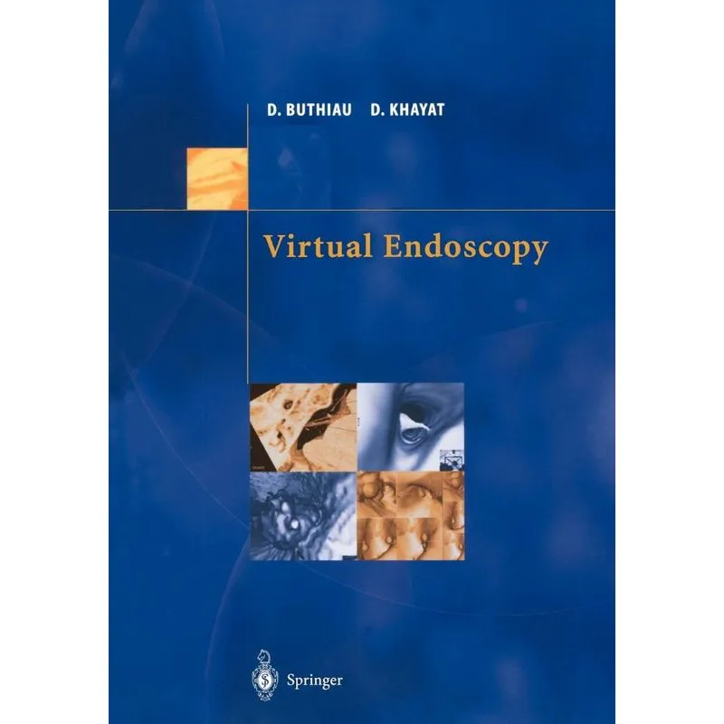 Virtual Endoscopy