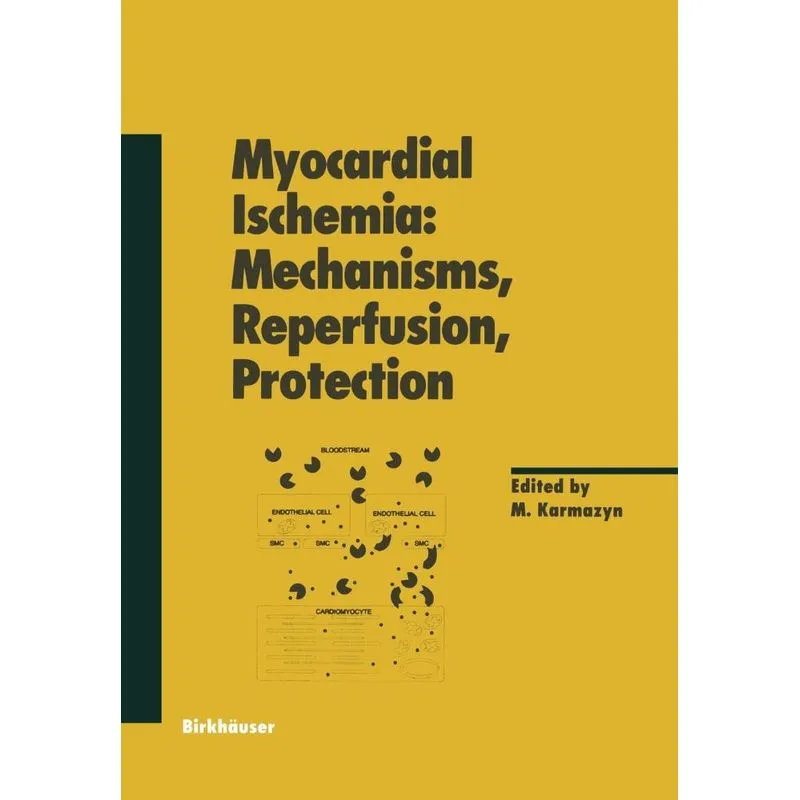 Myocardial Ischemia