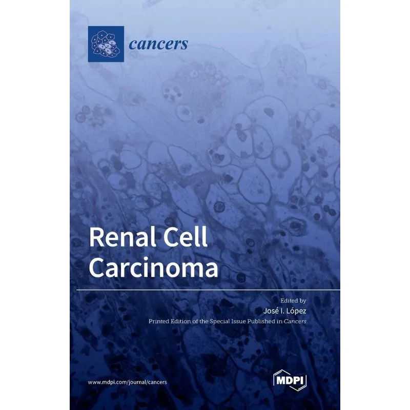 Renal Cell Carcinoma