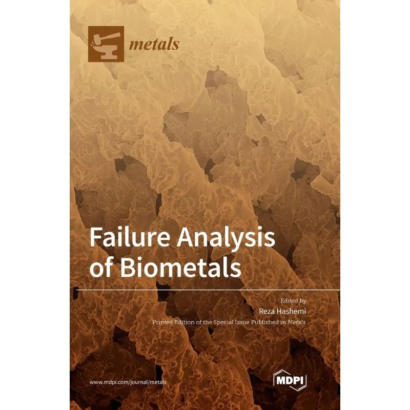Failure Analysis of Biometals
