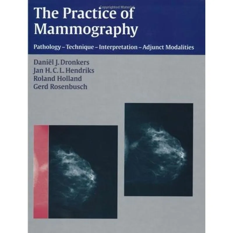 Practice of Mammography