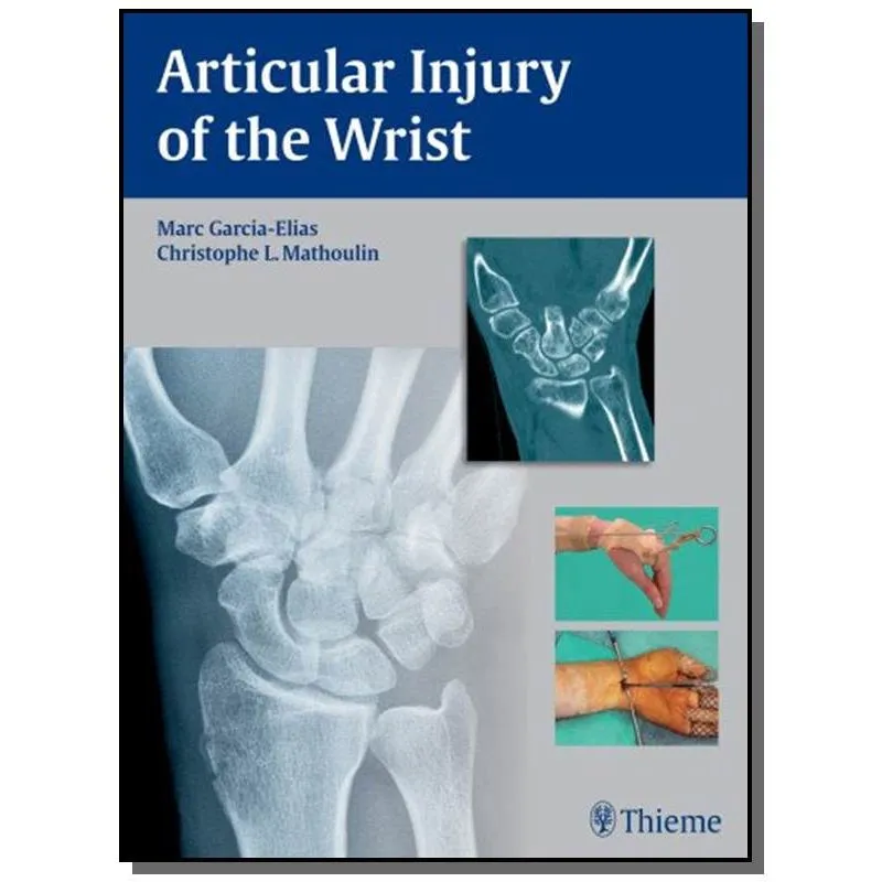 Articular Injury Of The Wrist