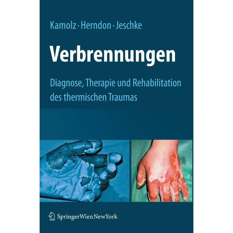 Verbrennungen