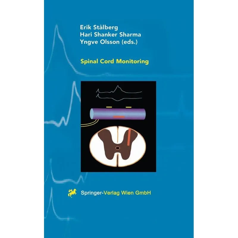 Spinal Cord Monitoring