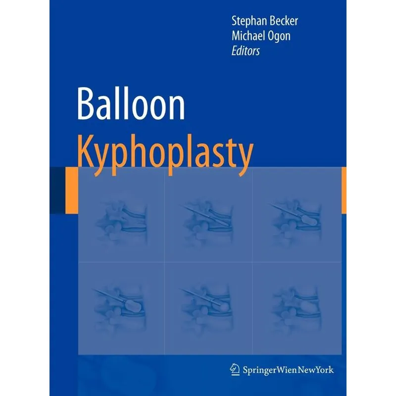 Balloon Kyphoplasty