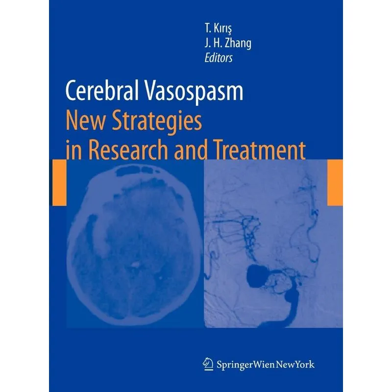 Cerebral Vasospasm