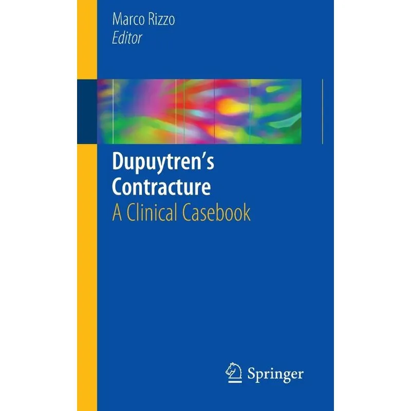Dupuytrens Contracture