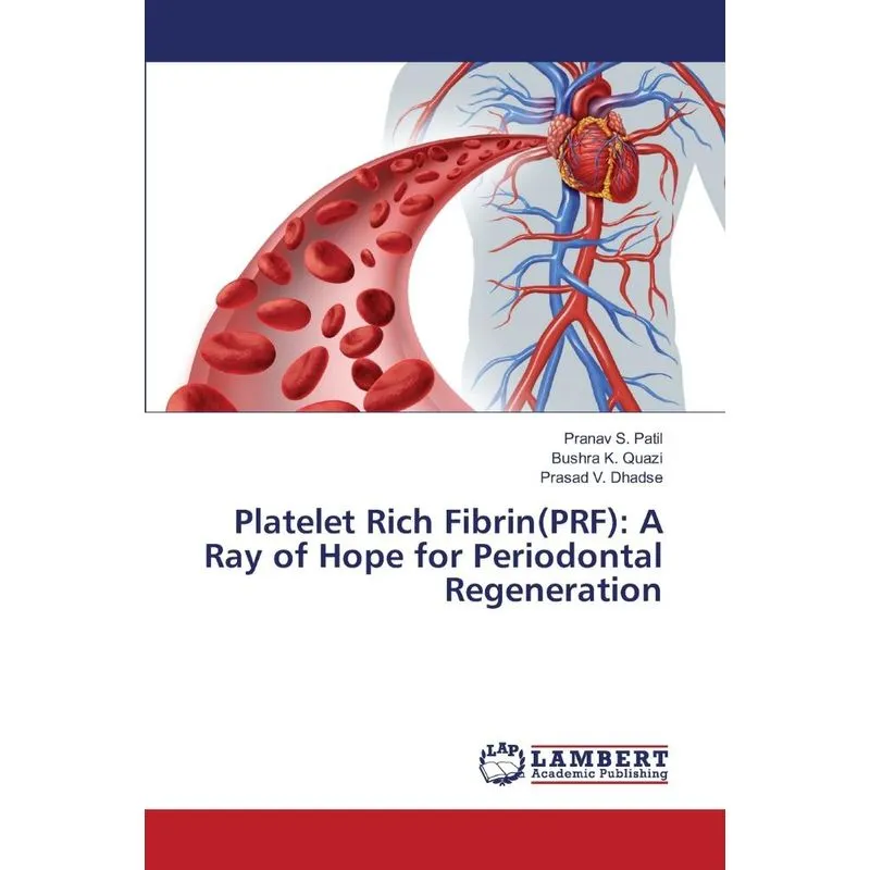Platelet Rich Fibrin(PRF)