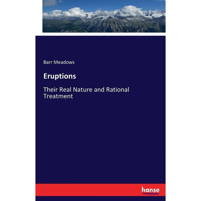 Eruptions