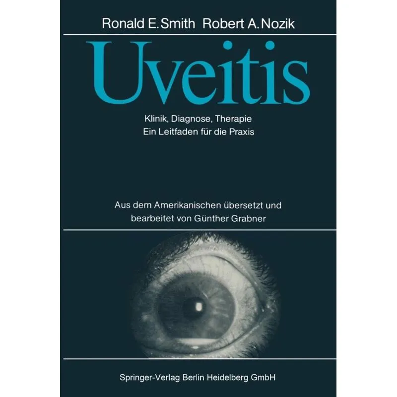 Uveitis