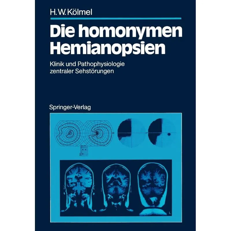 Die homonymen Hemianopsien