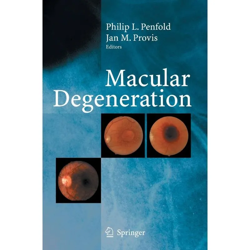 Macular Degeneration