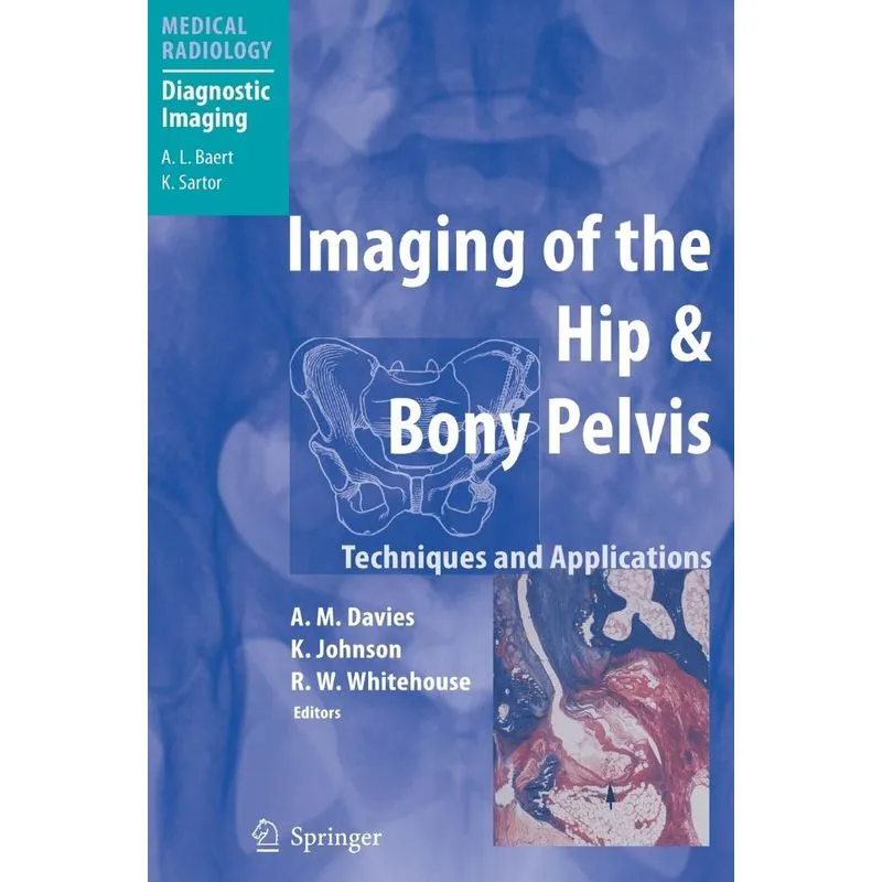 Imaging of the Hip & Bony Pelvis