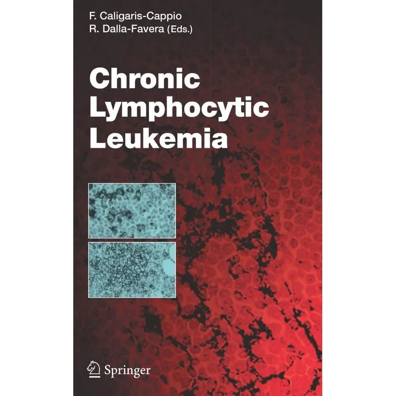 Chronic Lymphocytic Leukemia