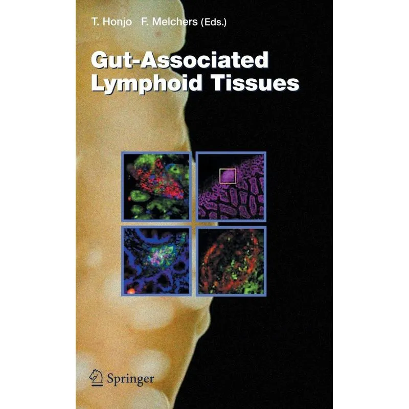 Gut-Associated Lymphoid Tissues