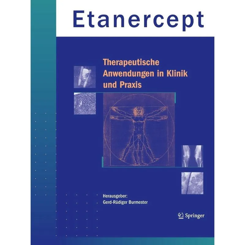 Etanercept - Therapeutische Anwendungen in Klinik und Praxis