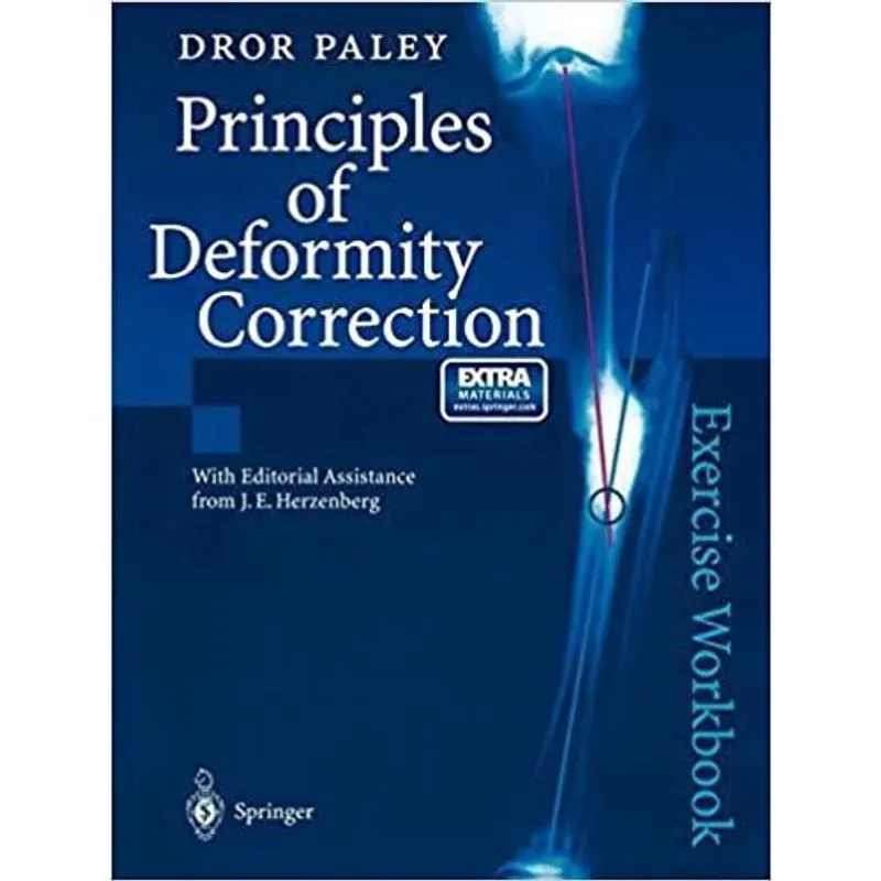 Principles Of Deformity Correction Exercise Book