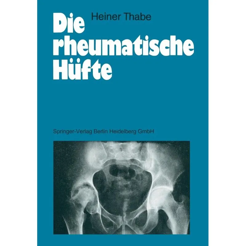 Die Rheumatische Hufte