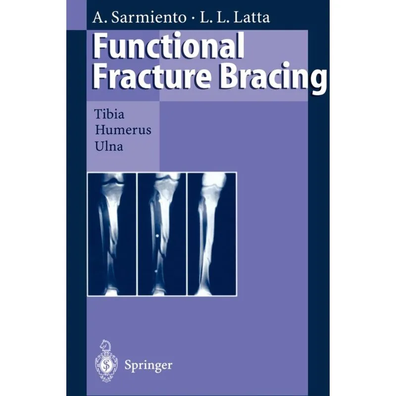 Functional Fracture Bracing