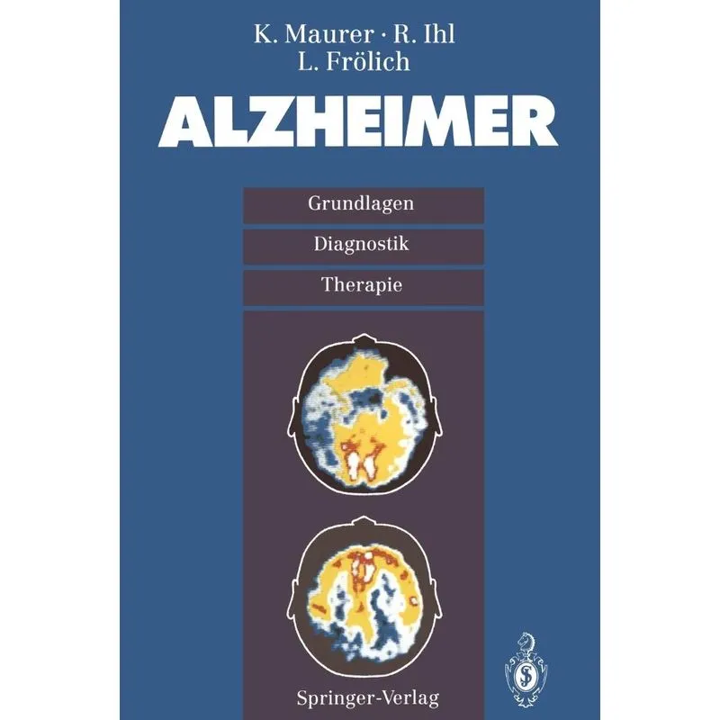 Alzheimer
