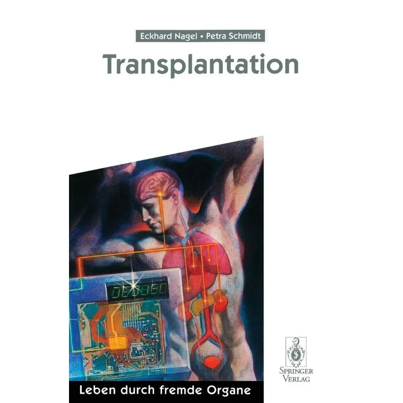 Transplantation