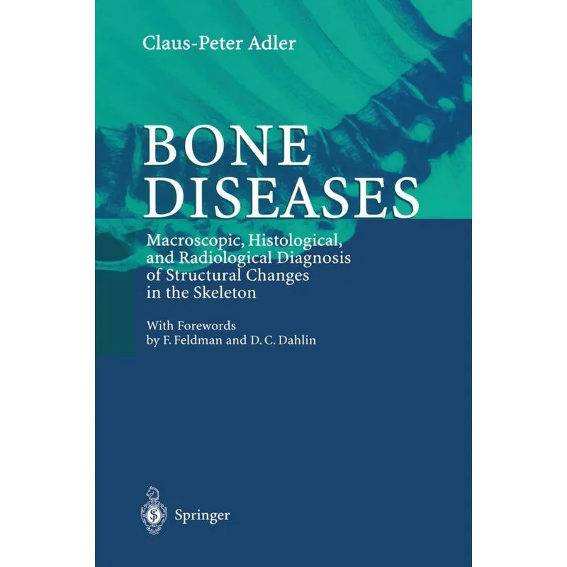 Bone Diseases