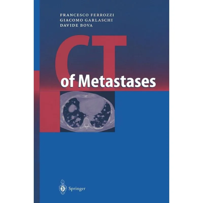 CT of Metastases
