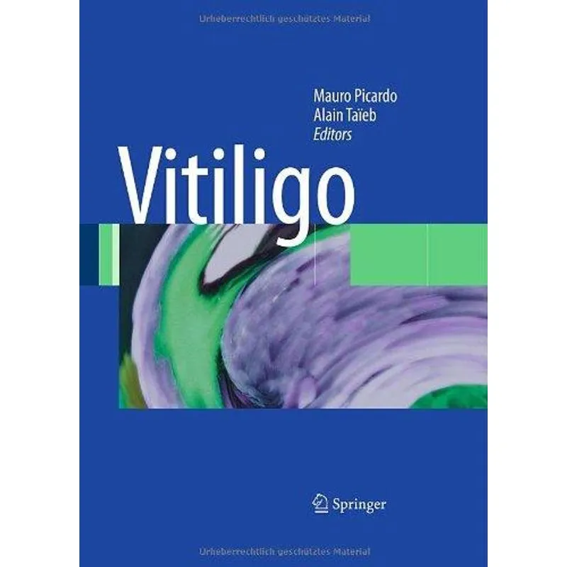 Vitiligo
