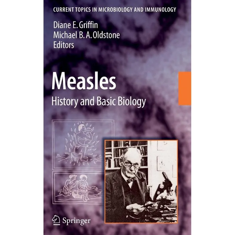 Measles