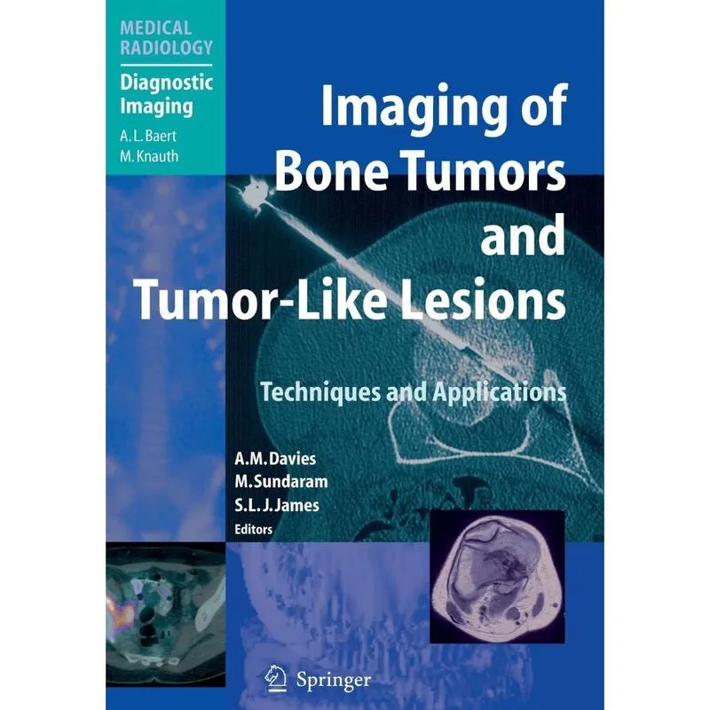 Imaging of Bone Tumors and Tumor-Like Lesions
