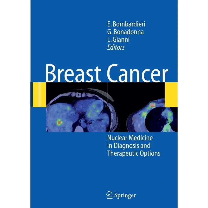 Breast Cancer