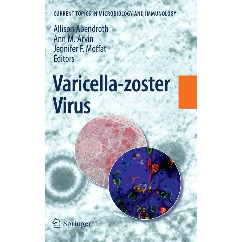 Varicella-zoster Virus