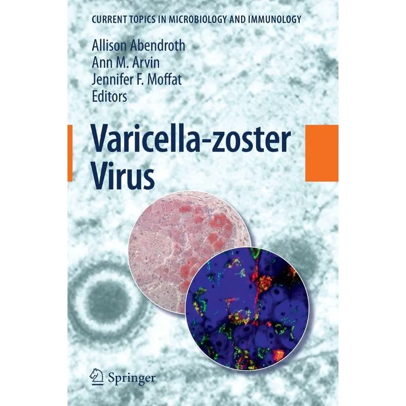 Varicella-zoster Virus