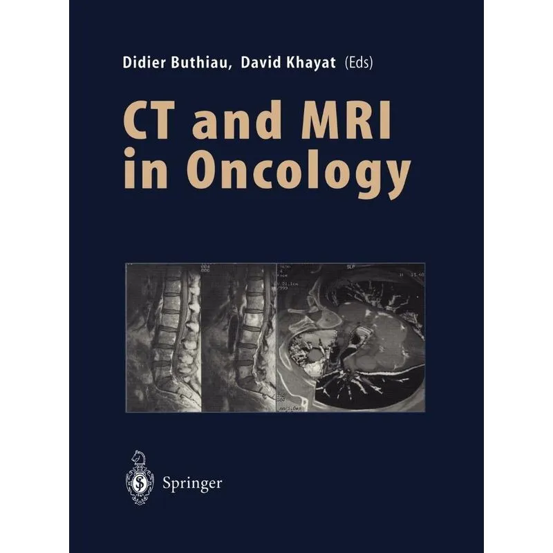 CT and MRI in Oncology