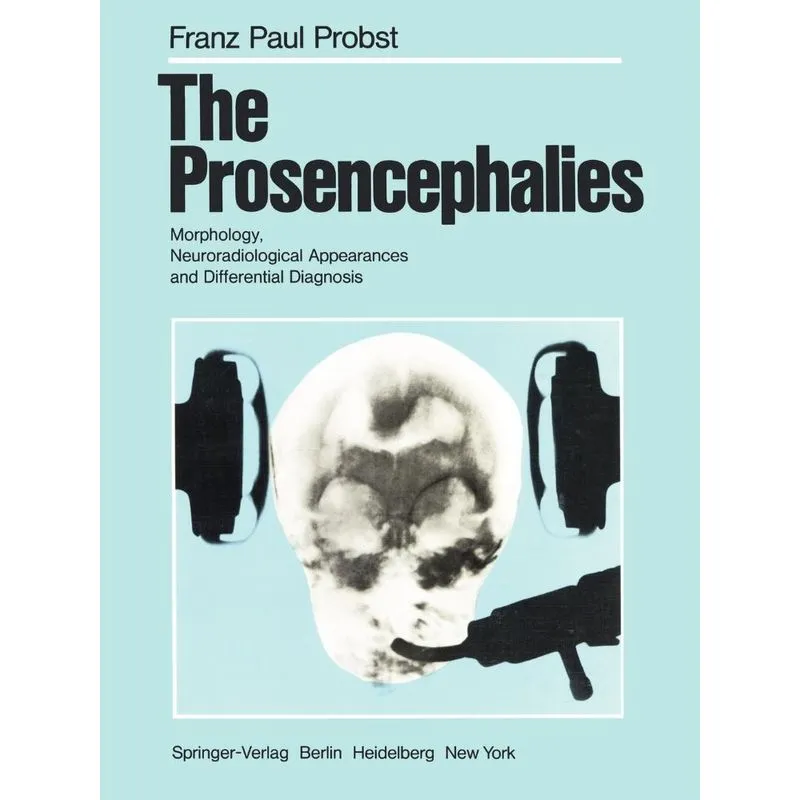 The Prosencephalies