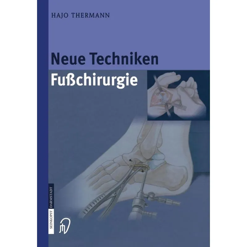 Neue Techniken Fusschirurgie