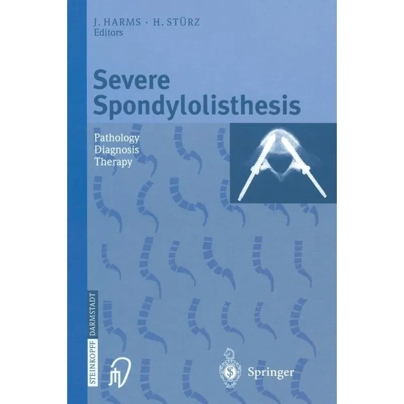 Severe Spondylolisthesis