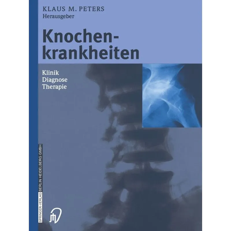 Knochenkrankheiten