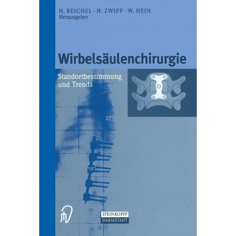 Wirbelsäulenchirurgie
