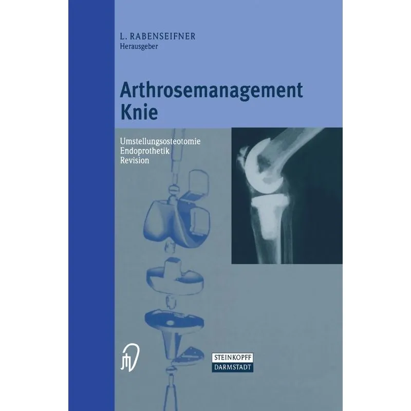 Arthrosemanagement Knie