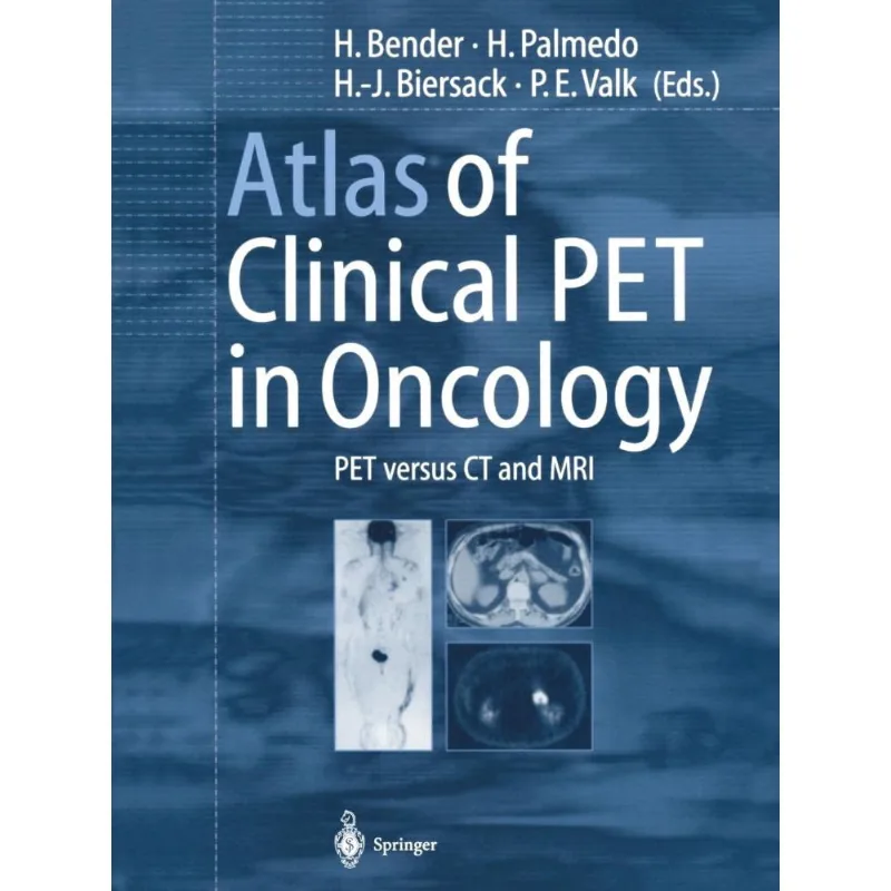 Atlas of Clinical Pet in Oncology